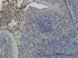 RSK4 Antibody (8H5), Novus Biologicals 0.1 mg | Buy Online | Novus Biologicals | Fisher Scientific