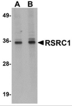 RSRC1 Antibody - BSA Free, Novus Biologicals 0.1 mg; Unconjugated:Antibodies,