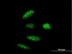 RTCD1 Antibody, Novus Biologicals 0.05 mg | Buy Online | Novus Biologicals | Fisher Scientific