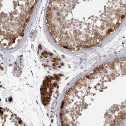 RTCD1 Antibody, Novus Biologicals 25 &mu;L | Buy Online | Novus Biologicals | Fisher Scientific