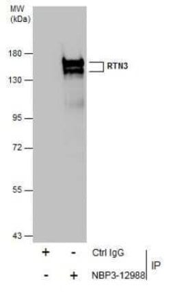 RTN3 Antibody, Novus Biologicals 100 &mu;g | Buy Online | Novus Biologicals | Fisher Scientific