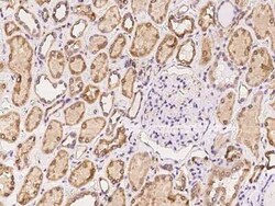 RTVP-1/GLIPR1 Antibody, Novus Biologicals:Antibodies:Primary Antibodies