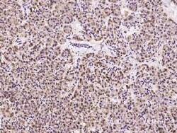 RTVP-1/GLIPR1 Antibody, Novus Biologicals:Antibodies:Primary Antibodies