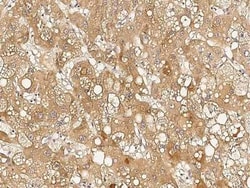 RTVP-1/GLIPR1 Antibody, Novus Biologicals:Antibodies:Primary Antibodies