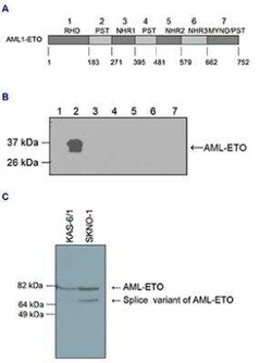 RUNX1T1/ETO Rabbit anti-Human, Polyclonal, Novus Biologicals:Antibodies:Primary