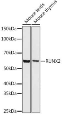 RUNX2/CBFA1 Rabbit anti-Human, Mouse, Clone: 7O7J4, Novus Biologicals:Antibodies:Primary