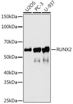 RUNX2/CBFA1 Rabbit anti-Human, Mouse, Clone: 7O7J4, Novus Biologicals:Antibodies:Primary