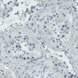 RUNX2/CBFA1 Antibody (CL0232), Novus Biologicals 25 &mu;L, Unconjugated:Antibodies,