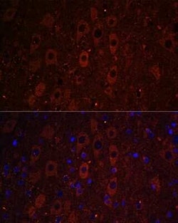 RUSC1 Antibody - Azide and BSA Free, Novus Biologicals:Antibodies:Primary
