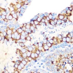 RUVBL1 Rabbit anti-Human, Mouse, Rat, Clone: 7Q2U8, Novus Biologicals:Antibodies:Primary