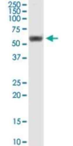 RUVBL1 Antibody (3G4-1F8), Novus Biologicals 0.1 mg | Buy Online | Novus Biologicals | Fisher Scientific