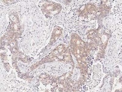 RUVBL1 Antibody, Novus Biologicals:Antibodies:Primary Antibodies