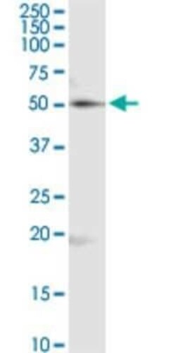 RUVBL2 Antibody (3C6), Novus Biologicals 0.1 mg | Buy Online | Novus Biologicals | Fisher Scientific