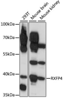 RXFP4/GPCR142/GPR100 Antibody - Azide and BSA Free, Novus Biologicals 0.1