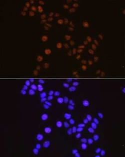 RXR alpha/NR2B1 Rabbit anti-Human, Mouse, Rat, Clone: 6Y10M1, Novus Biologicals:Antibodies:Primary