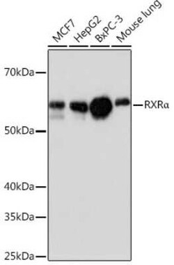 RXR alpha/NR2B1 Rabbit anti-Human, Mouse, Rat, Clone: 6Y10M1, Novus Biologicals:Antibodies:Primary