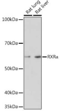 RXR alpha/NR2B1 Rabbit anti-Human, Mouse, Rat, Clone: 6Y10M1, Novus Biologicals:Antibodies:Primary