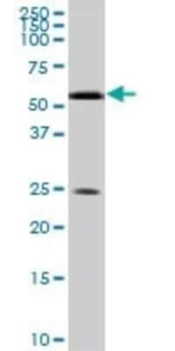 RXR alpha/NR2B1 Antibody (1D7), Novus Biologicals 0.1 mg | Buy Online | Novus Biologicals | Fisher Scientific