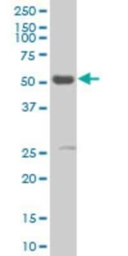 RXR alpha/NR2B1 Antibody (1D7), Novus Biologicals 0.1 mg | Buy Online | Novus Biologicals | Fisher Scientific