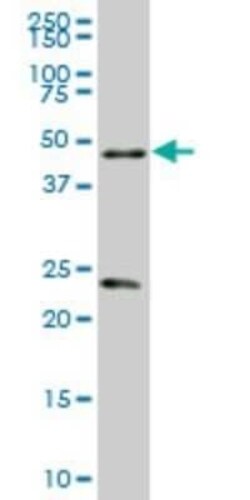 RXR alpha/NR2B1 Antibody (4D6), Novus Biologicals 0.1 mg | Buy Online | Novus Biologicals | Fisher Scientific