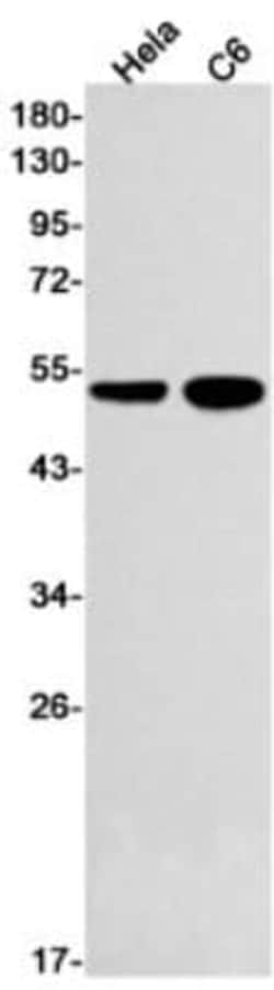 RXR alpha/NR2B1 Antibody (S04-6C3), Novus Biologicals:Antibodies:Primary