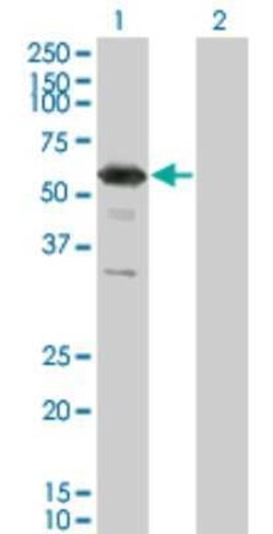RXR gamma/NR2B3 Antibody (6H1), Novus Biologicals 0.1 mg | Buy Online | Novus Biologicals | Fisher Scientific