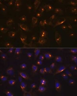 Rab11A Rabbit anti-Human, Mouse, Rat, Clone: 3O4R8, Novus Biologicals 20 &mu;g | Buy Online | Novus Biologicals | Fisher Scientific