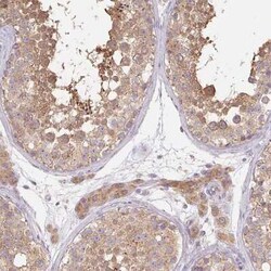 Rab11A Antibody, Novus Biologicals:Antibodies:Primary Antibodies