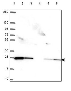 Rab11A Antibody, Novus Biologicals:Antibodies:Primary Antibodies