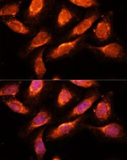 Rab1A Antibody - Azide and BSA Free, Novus Biologicals 0.02 mL; Unconjugated:Antibodies,