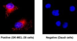 Human Rab27a Antibody, R D Systems 25 &mu;g; Unconjugated:Antibodies, Monoclonal
