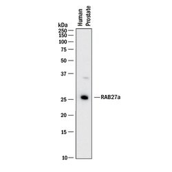 Human Rab27a Antibody, R D Systems 25 &mu;g; Unconjugated:Antibodies, Monoclonal