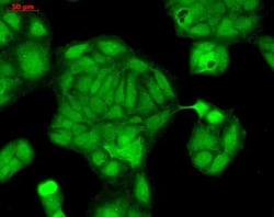 Rab4 Rabbit anti-Human, Mouse, Rat, Polyclonal, Novus Biologicals 25 &mu;g | Buy Online | Novus Biologicals | Fisher Scientific