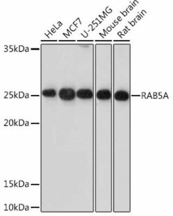 Rab5a Rabbit anti-Human, Mouse, Rat, Clone: 0K5J1, Novus Biologicals 100 &mu;g | Buy Online | Novus Biologicals | Fisher Scientific