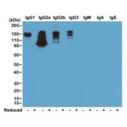 IgG Antibody (RM104), Biotin, Novus Biologicals 50 &mu;g | Buy Online | Novus Biologicals | Fisher Scientific