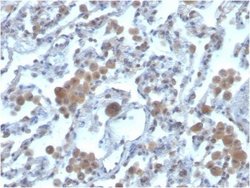 Rac1 Antibody (CPTC-RAC1-1) - Azide and BSA Free, Novus Biologicals 100