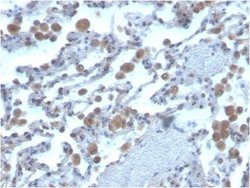 Rac1 Antibody (CPTC-RAC1-1) - Azide and BSA Free, Novus Biologicals 100