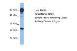 Rac1 Rabbit anti-Human, Mouse, Polyclonal, Novus Biologicals 0.1 mL | Buy Online | Novus Biologicals | Fisher Scientific