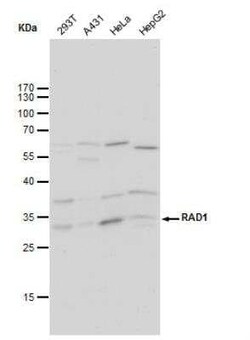 Rad1 Antibody (4126), Novus Biologicals 0.1 mL; Unconjugated:Antibodies,