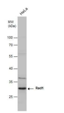 Rad1 Antibody (4126), Novus Biologicals 0.1 mL; Unconjugated:Antibodies,