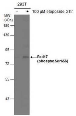 Rad17, p Ser656 Antibody, Novus Biologicals 100 &mu;g | Buy Online | Novus Biologicals | Fisher Scientific