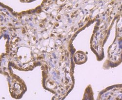 Rad51 Rabbit anti-Human, Mouse, Rat, Clone: JM54-26, Novus Biologicals