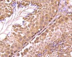 Rad51 Rabbit anti-Human, Mouse, Rat, Clone: JM54-26, Novus Biologicals