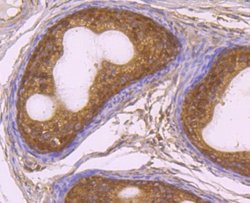 Rad51 Rabbit anti-Human, Mouse, Rat, Clone: JM54-26, Novus Biologicals