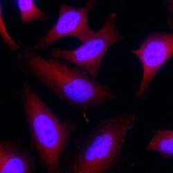 Rad51 Antibody (523713), Unconjugated, Novus Biologicals:Antibodies:Primary