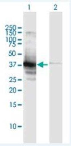 Rad51 Antibody, Novus Biologicals 0.05 mg | Buy Online | Novus Biologicals | Fisher Scientific