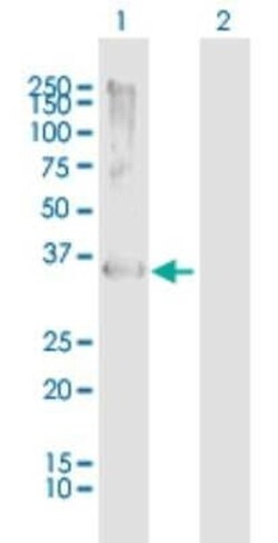Rad51 Antibody, Novus Biologicals 0.05 mg | Buy Online | Novus Biologicals | Fisher Scientific