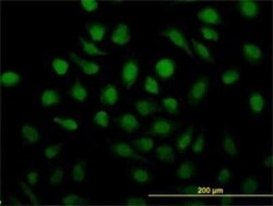 Rad51C Antibody (3F3-5C6), Novus Biologicals 0.1 mg | Buy Online | Novus Biologicals | Fisher Scientific