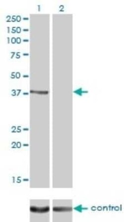 Rad51C Antibody (3F3-5C6), Novus Biologicals 0.1 mg | Buy Online | Novus Biologicals | Fisher Scientific