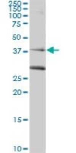 Rad51C Antibody (3F3-5C6), Novus Biologicals 0.1 mg | Buy Online | Novus Biologicals | Fisher Scientific